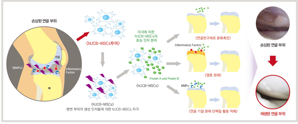 관절염 연골재생 줄기세포 치료제 카티스템