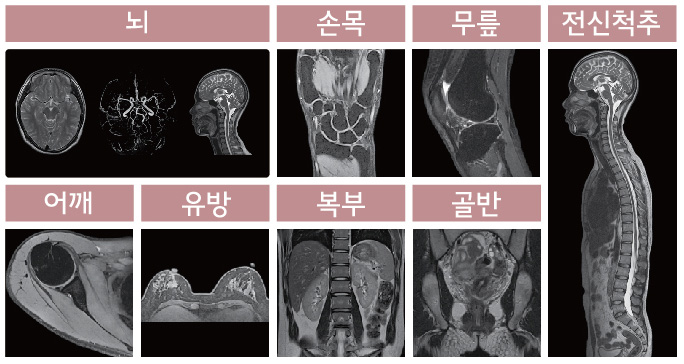 검사부위사진